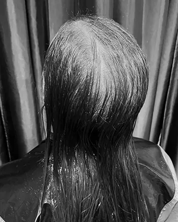   solutions before after womens gallery photos of womens hair loss solutions 01 womens hair loss solutions before and after 02