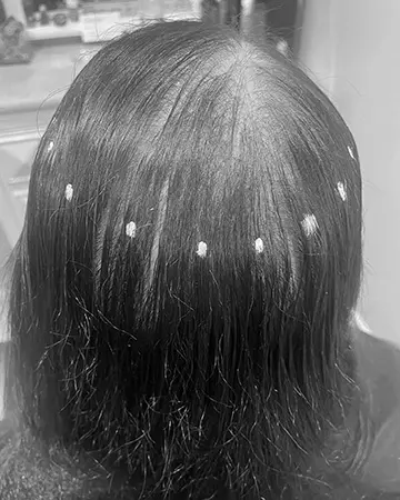  solutions before after womens gallery photos of womens hair loss solutions 03 womens hair loss solutions before and after 02