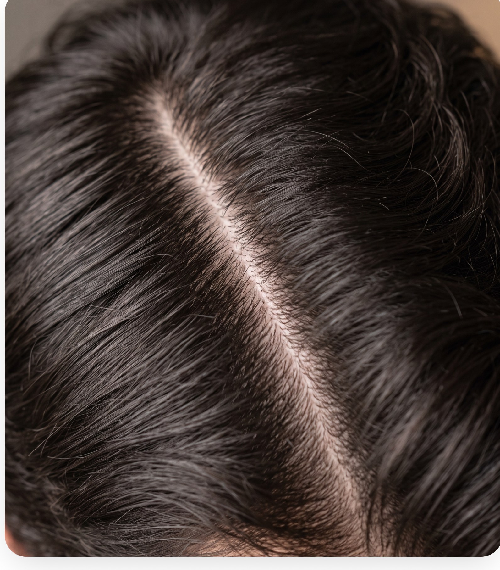 Close-up of a dark hair centre part showing density