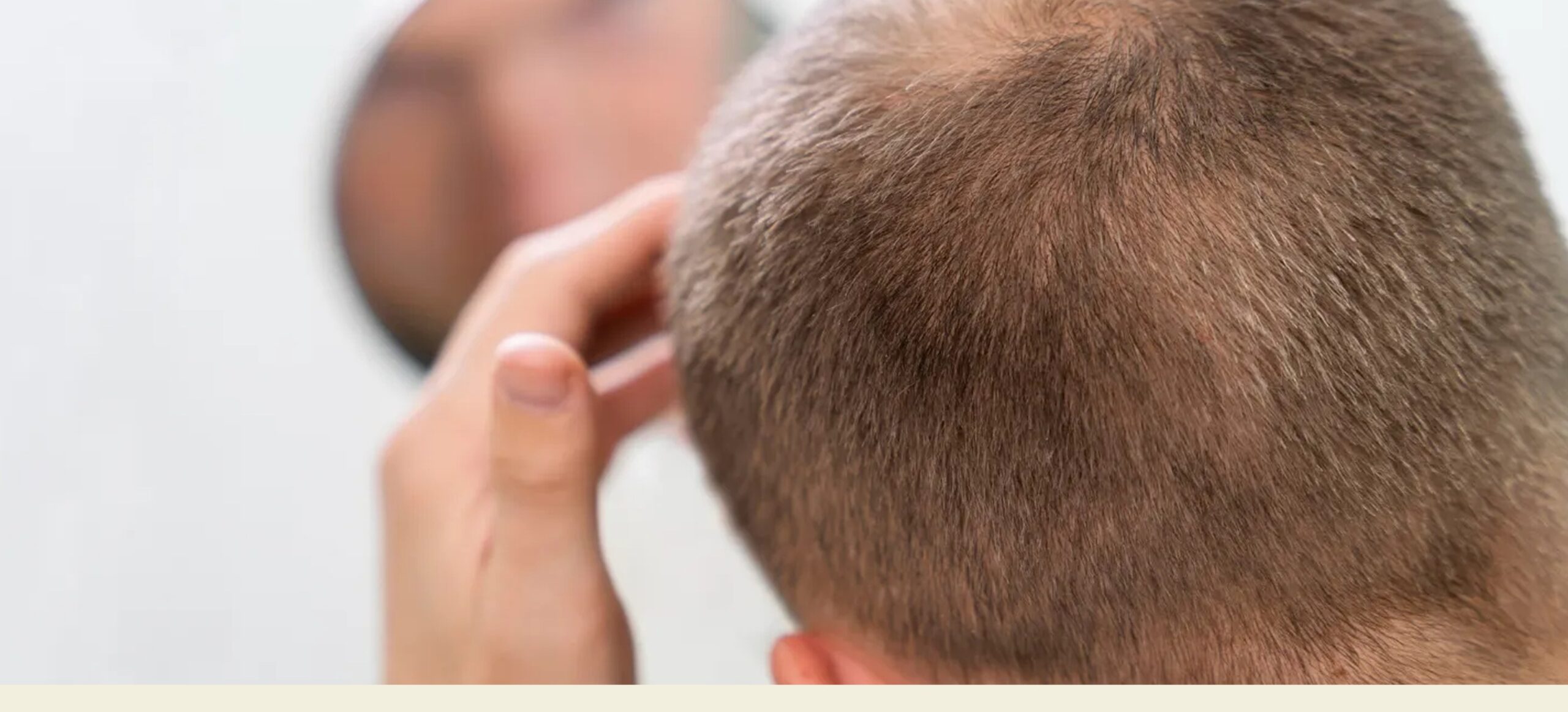 Close-up of a man's head and scalp during assessment
