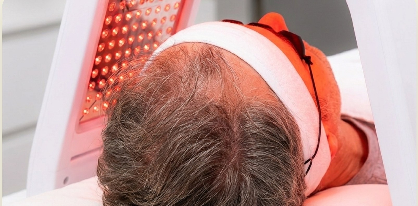 Scalp health and red light therapy