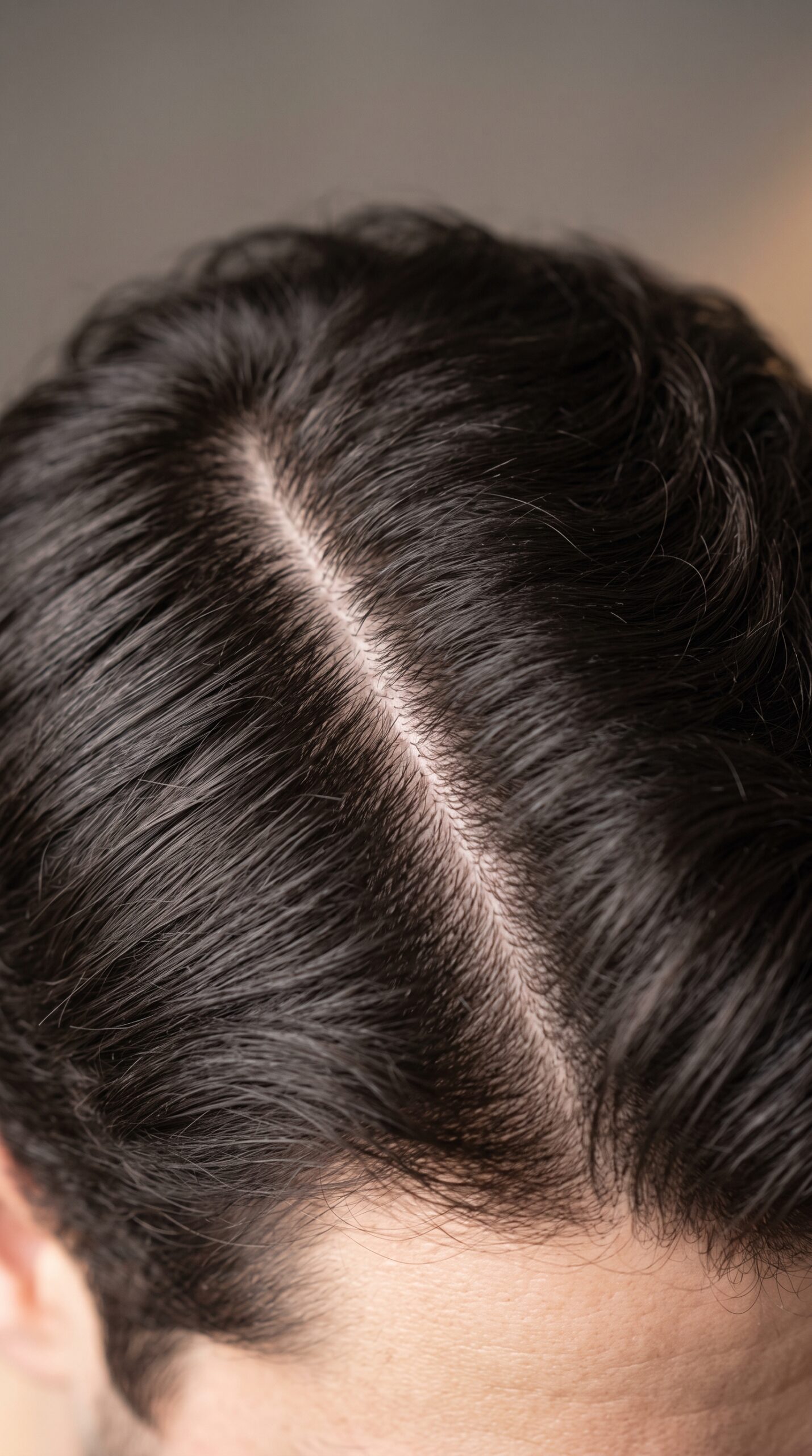 Close-up of a centre part showing hair density